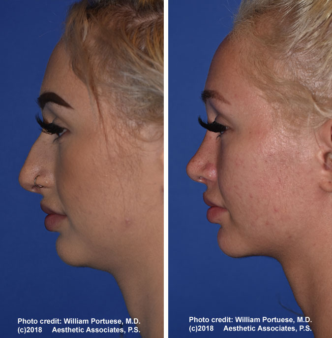 facial cosmetic surgery Portland Oregon