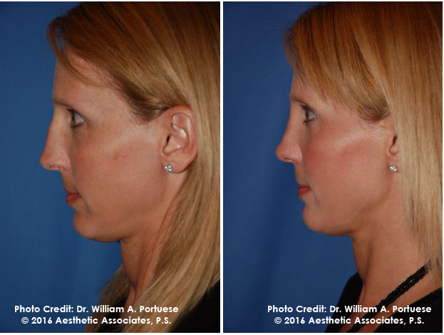 facial cosmetic surgeon Portland Oregon