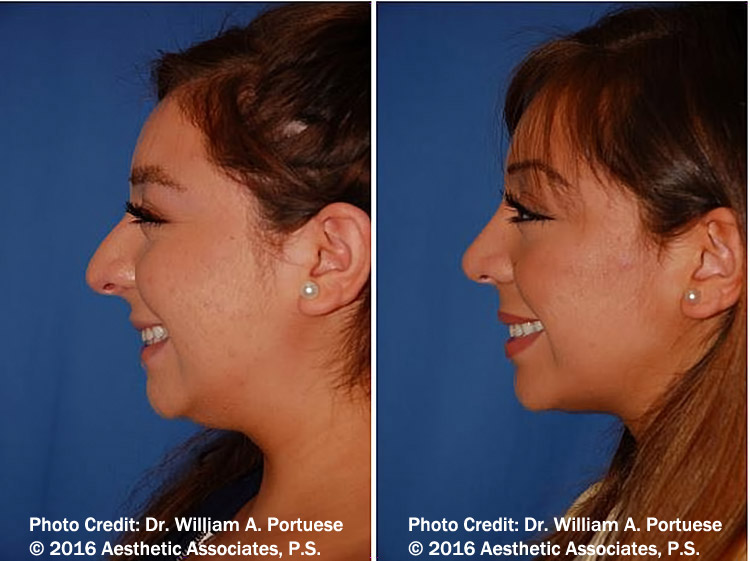 seattle facial plastic surgeon