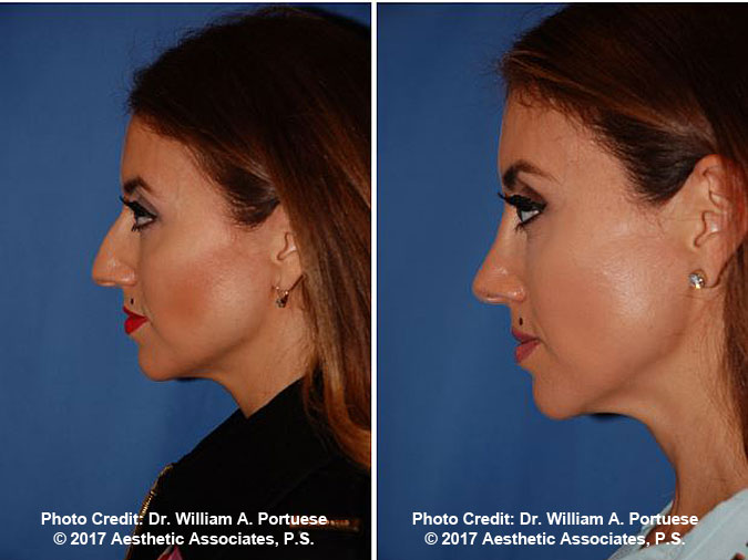 facial plastic surgeon seattle
