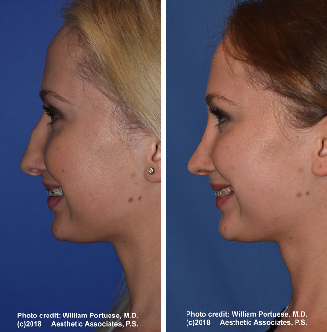 seattle facial plastic surgery center